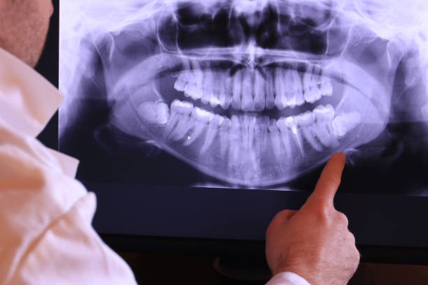 Best Urgent Dental Care for Toothaches in Morris, OK